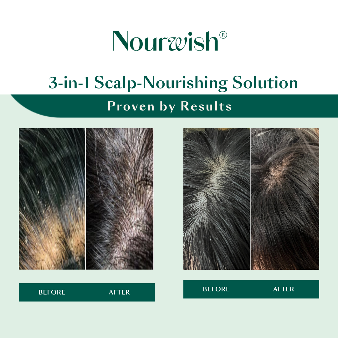 Scalp Retreat Nourishing Hair Serum